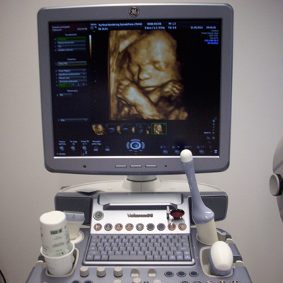 dr-inigo-fernandez-servicios-ecografias-obstetricas